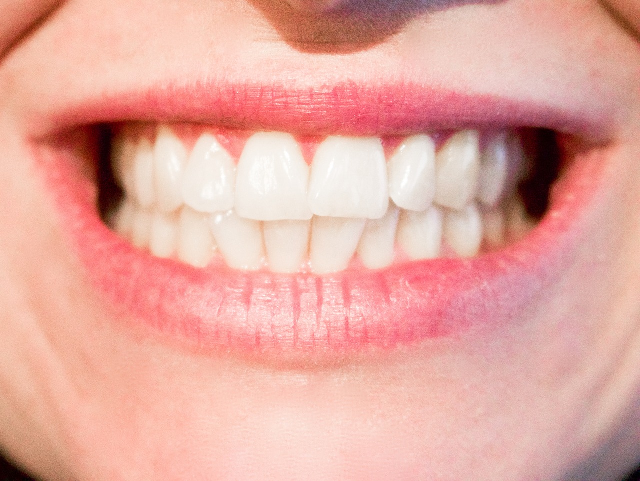 Problemy z zębami mądrości – chirurgiczne usuwanie ósemek. Dentysta w Warszawie