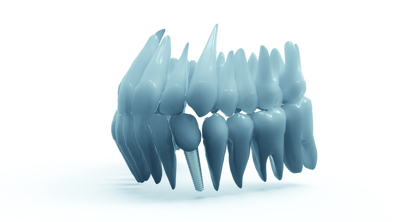 Sposoby na sztuczne zęby – korony porcelanowe. Protezy nylonowe