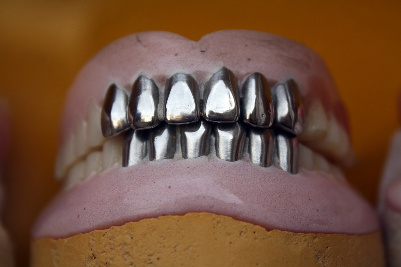 Co zrobić gdy proteza się popsuje? Naprawa protez zębowych Warszawa – jaka cena?